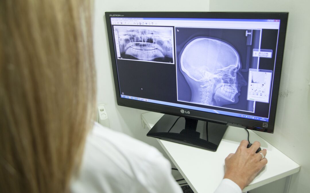 Do You Have A Case for a Missed Neck Fracture in Pennsylvania?