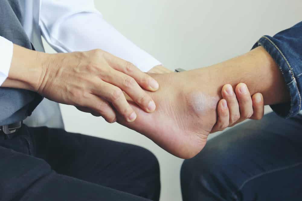 Do You Have A Case For A Missed Ankle Fracture The Thistle Law Firm   Broken Ankle Recovery Time 