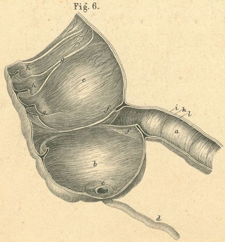 What Are the Early Warning Signs of Appendicitis?
