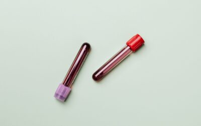 Can I Sue for Wrongful Death from Sepsis?