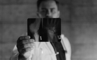 Do You Have a Case for a Missed Wrist Fracture?